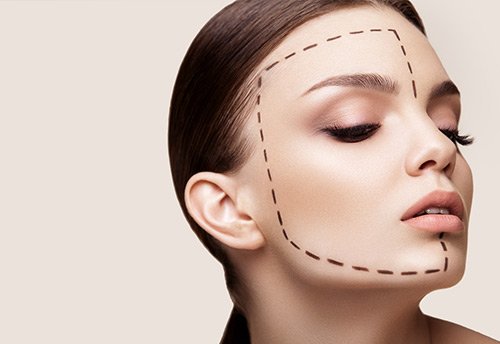 face-neck-lift ניתוח סינוסנים אנדוסקופי (FESS) | דוקטור שי דובדבני