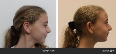 ----22 דוקטור שי דובדבני